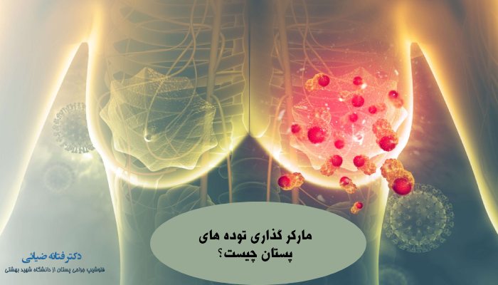 مارکر گذاری چیست؟