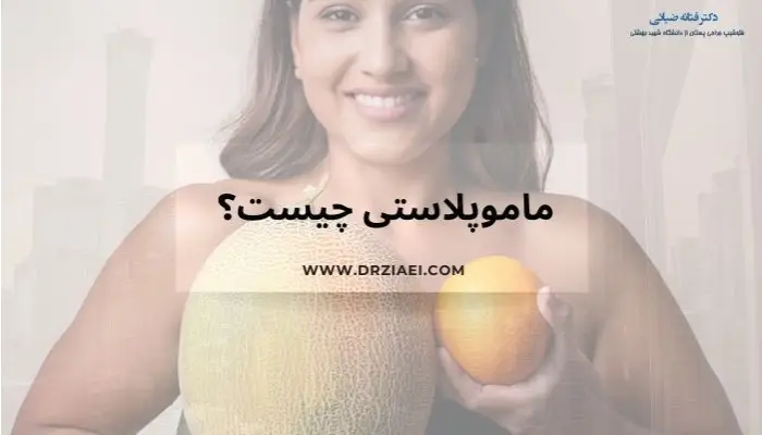 ماموپلاستی چیست؟