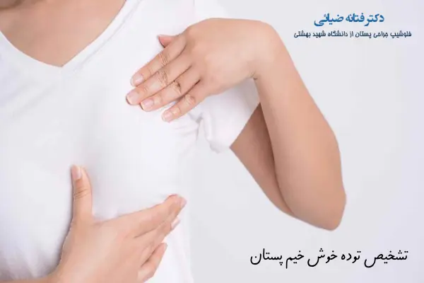 تشخیص توده خوش خیم پستان