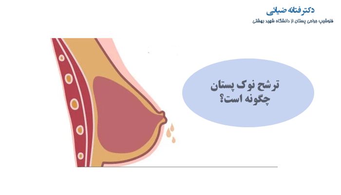 ترشح نوک پستان چگونه است؟