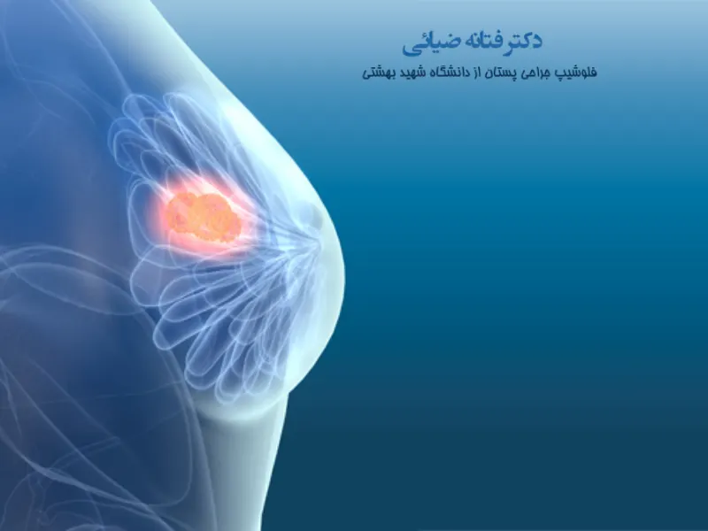 نمونه برداری از سینه