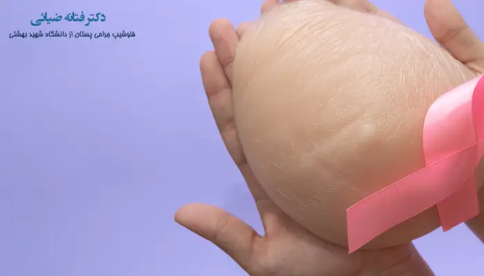 چالش های پروتز سینه و سرطان