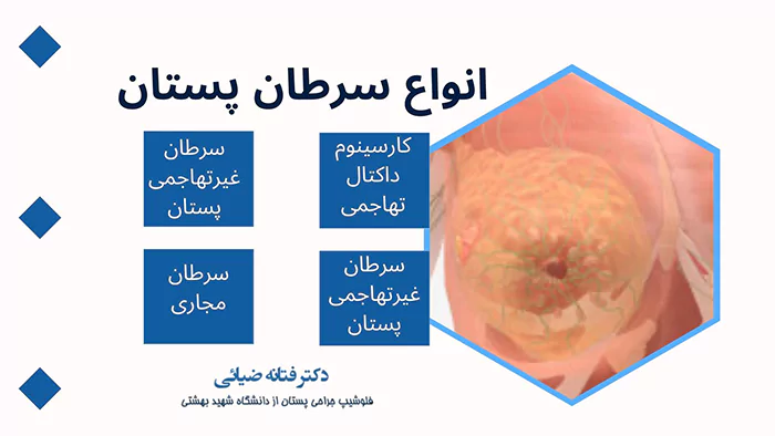 انواع سرطان پستان