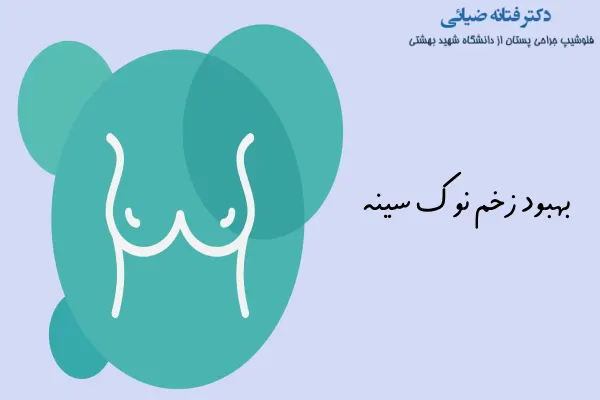 بهبود زخم نوک سینه