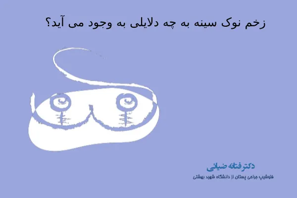 دلایل زخم نوک سینه