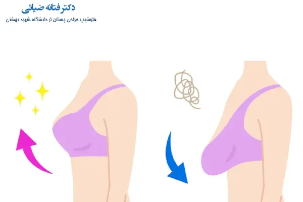 بهترین جراح لیفت سینه کیست؟