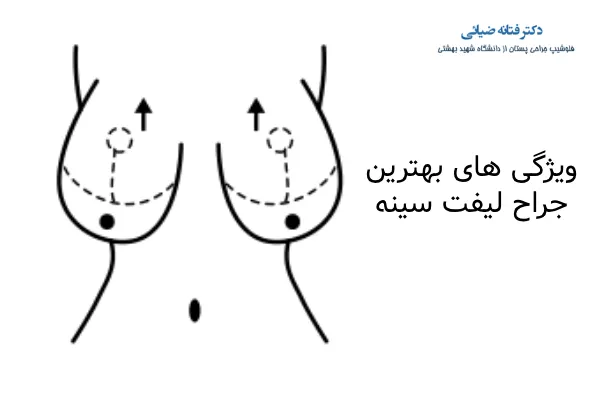 ویژگی های بهترین جراح لیفت سینه