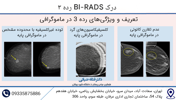 معنی birads در تفسیر ماموگرافی