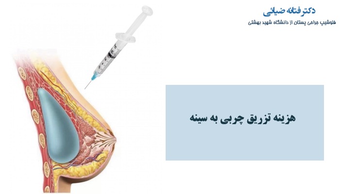 هزینه تزریق چربی به سینه چقدره؟