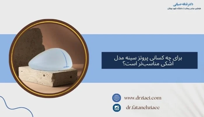 کاندیدای پروتز سینه مدل اشکی