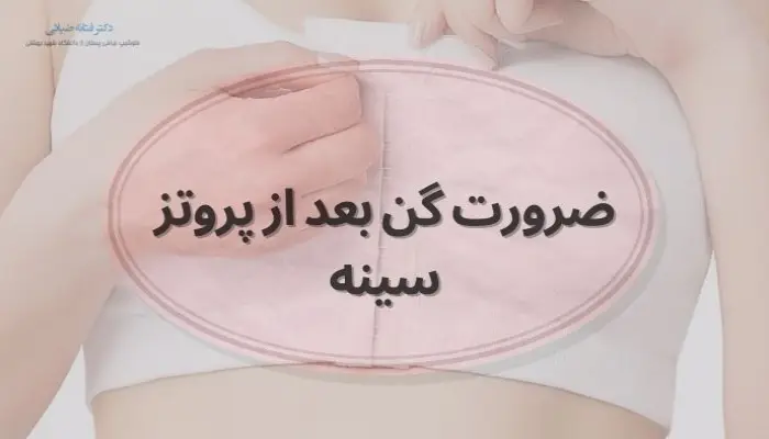 ضرورت استفاده از گن بعد از پروتز سینه