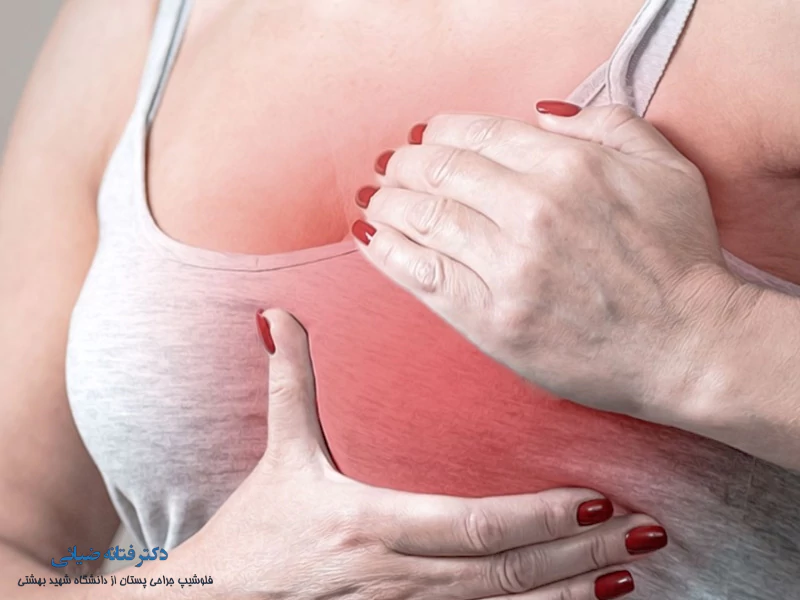 درمان سرطان سینه و پستان