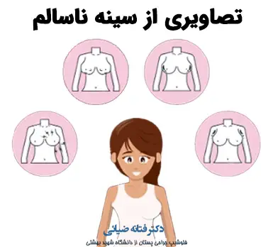 عکس سینه نا سالم